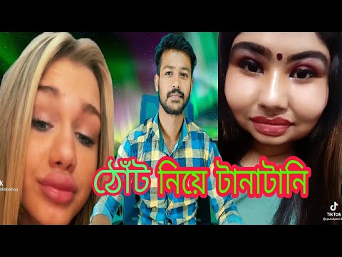 ঠোঁট নিয়ে টানাটানি || lips surery || trending || bangla funny video || ms bangla music