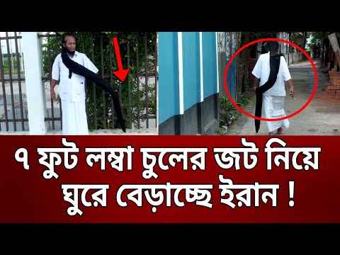৭ ফুট লম্বা চুলের জট নিয়ে ঘুরে বেড়াচ্ছে ইরান ! | Bangla News | Mytv News