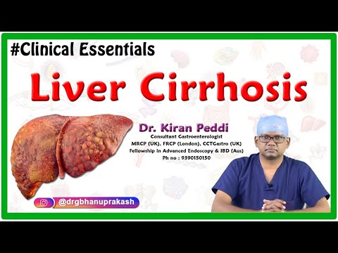 Liver Cirrhosis (Clinical essentials) – Dr. Kiran Peddi MRCP(UK), FRCP(London), CCT(Gastro)