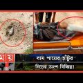 এবার মিয়ানমারের মাইনে উড়ে গেল বাংলাদেশি যুবকের পা! | Myanmar-Bangladesh Conflict | Somoy TV