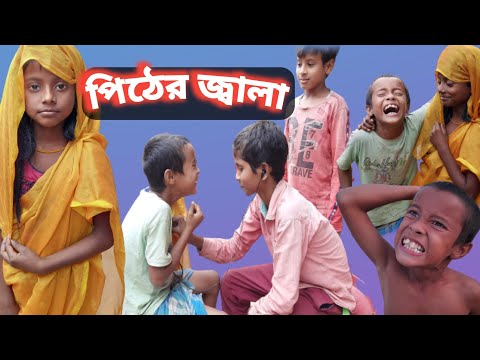 পিঠের জ্বালা || Bangla Funny Video || Bangla Natok || Sunday Music ||